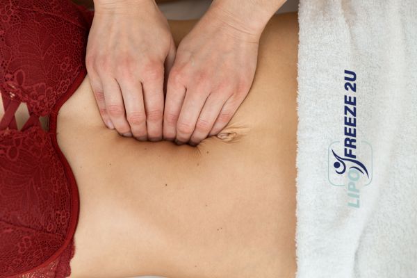 diastasis recti treatment Yeovil