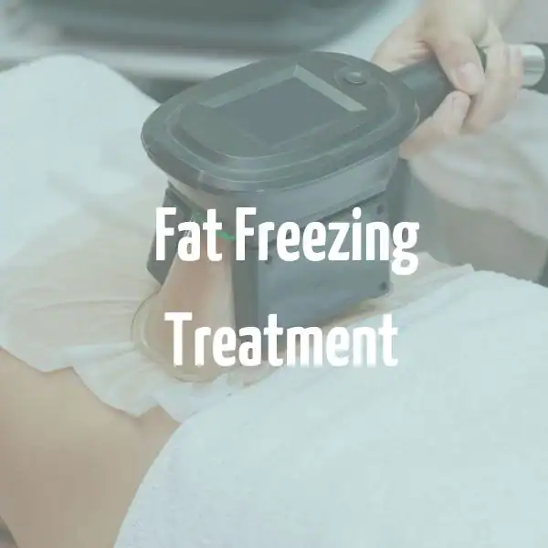 fat freezing treatment Yeovil