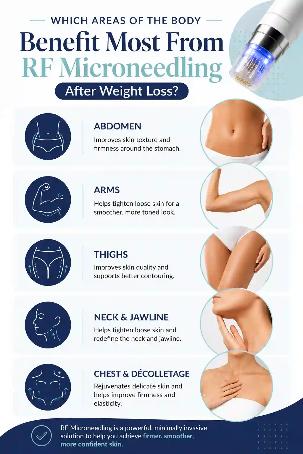 Which Areas of the Body Benefit Most From RF Microneedling After Weight Loss Yeovil